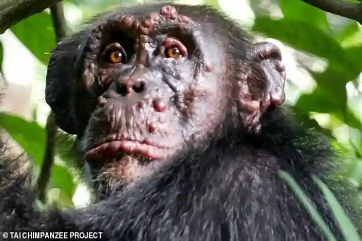 Leprosy, mankind’s age-old scourge affects chimpanzees too, reveals an international study