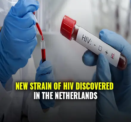 New Highly Virulent Of HIV Discovered In The Netherlands | HIV VB Variant | New HIV Variant