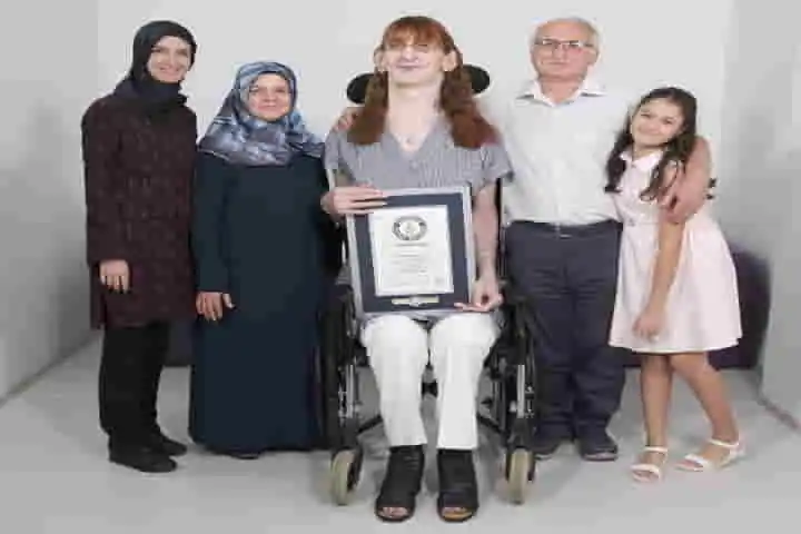Towering above 7 feet, Turkey’s Rumeysa Gelgi is the world’s tallest living woman