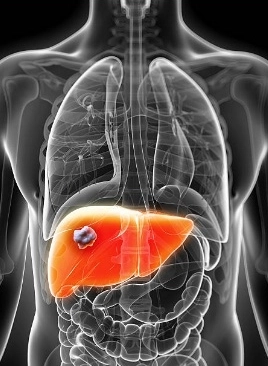 ’35 per cent of population in India suffers from fatty liver’