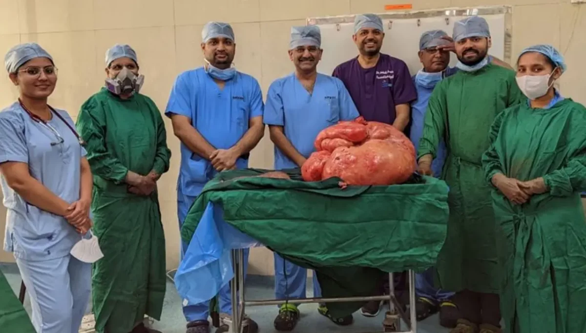 47-kg tumour removed from woman’s abdomen