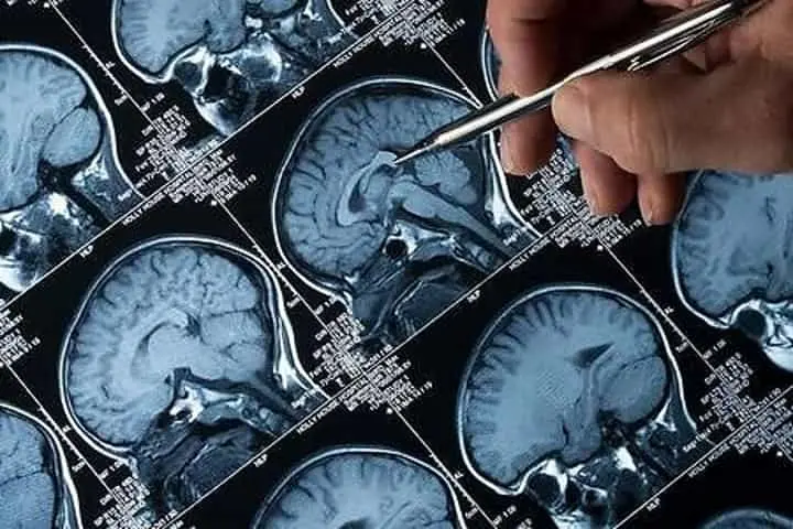 Delhi hospital gets India’s first brain mapping technology