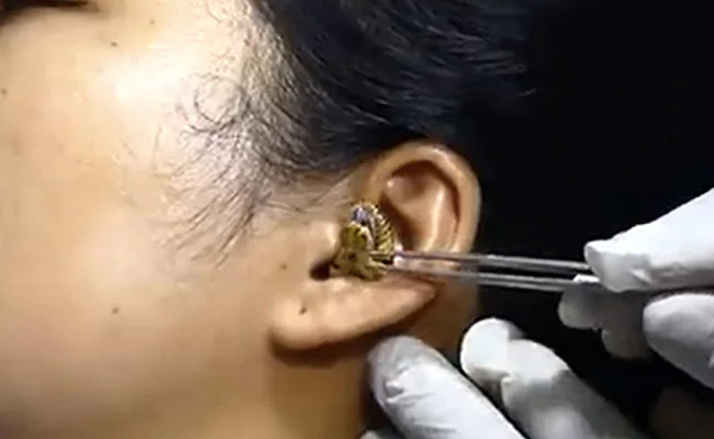 Viral video: Snake gets stuck in woman’s ear